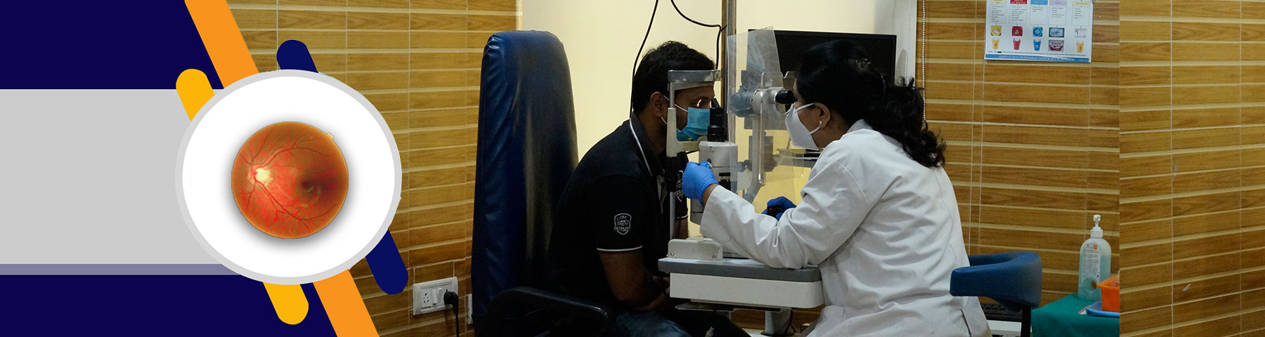 GLAUCOMA SERVICES