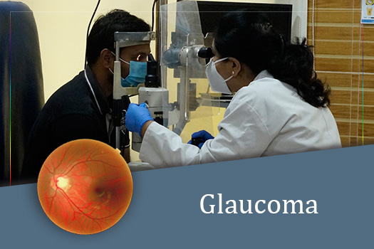glaucoma