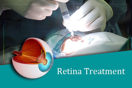 retina